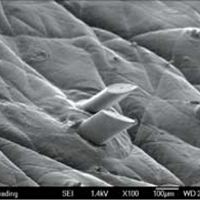 Microscopic image of hair