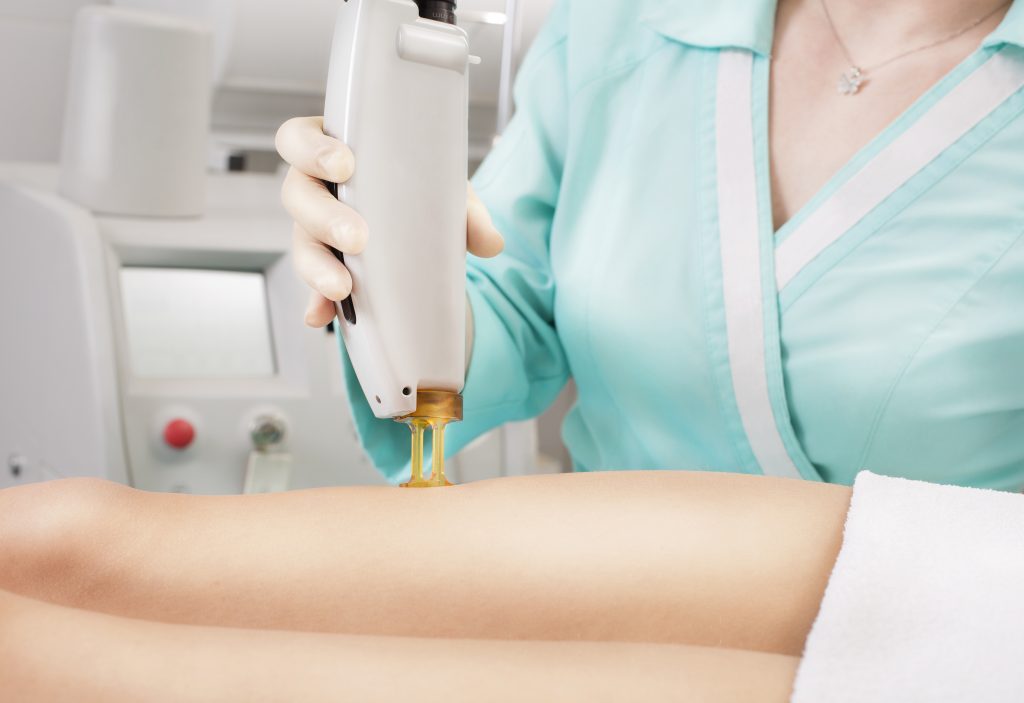 Waxing Center: Waxing v. Laser Hair Removal