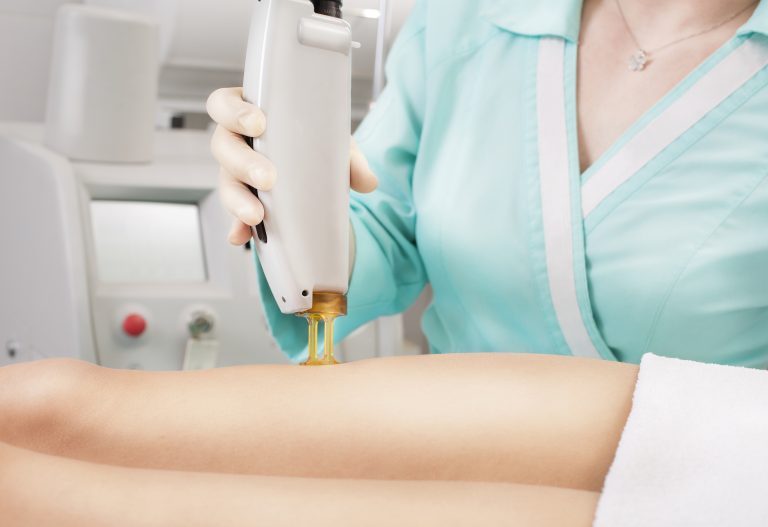 Waxing Center Waxing v. Laser Hair Removal